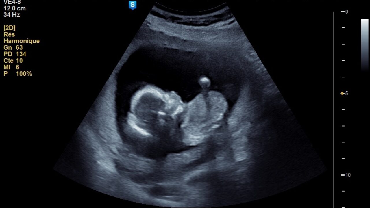 Echographie obstétricale de la CROISSANCE du fœtus chez la femme enceinte  sur ordonnance - Centre de santé du Marais