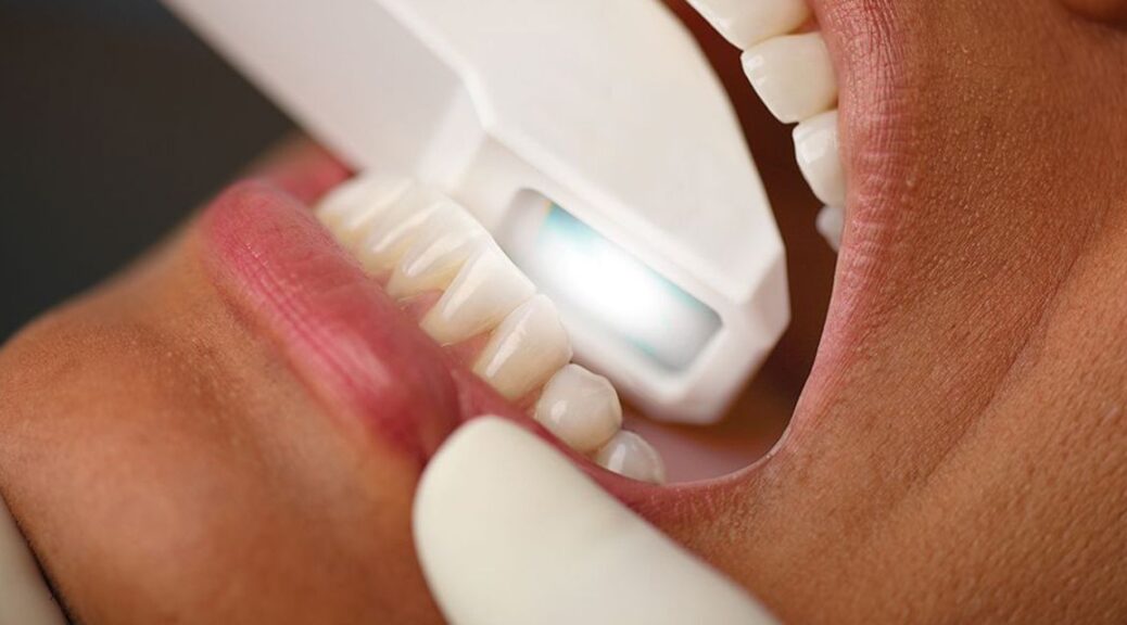 scanner intra oral