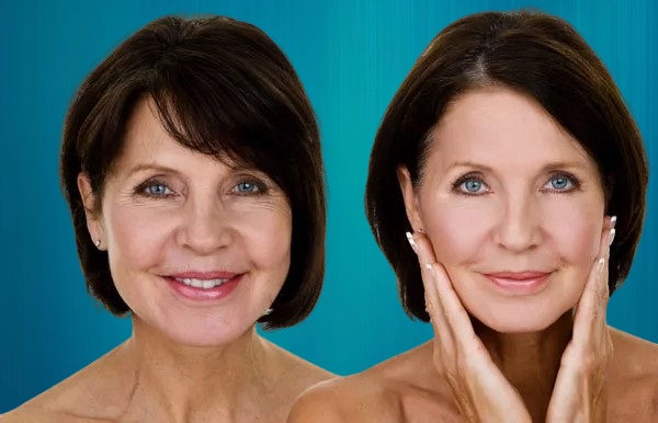 lifting vertical facial